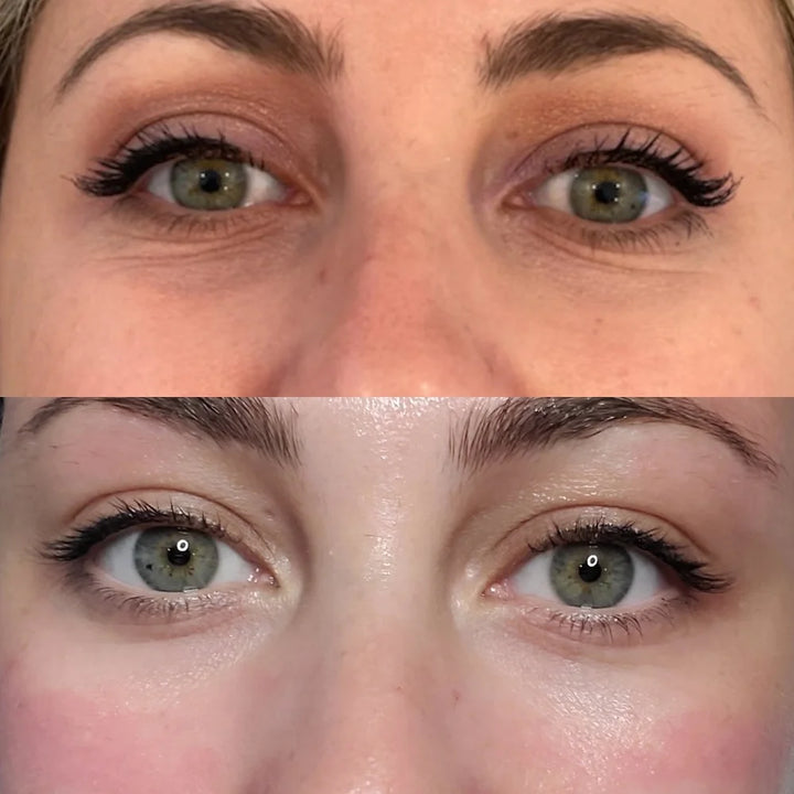 Bright Eyes Eye Cream - Anti-Aging & Hydrating.